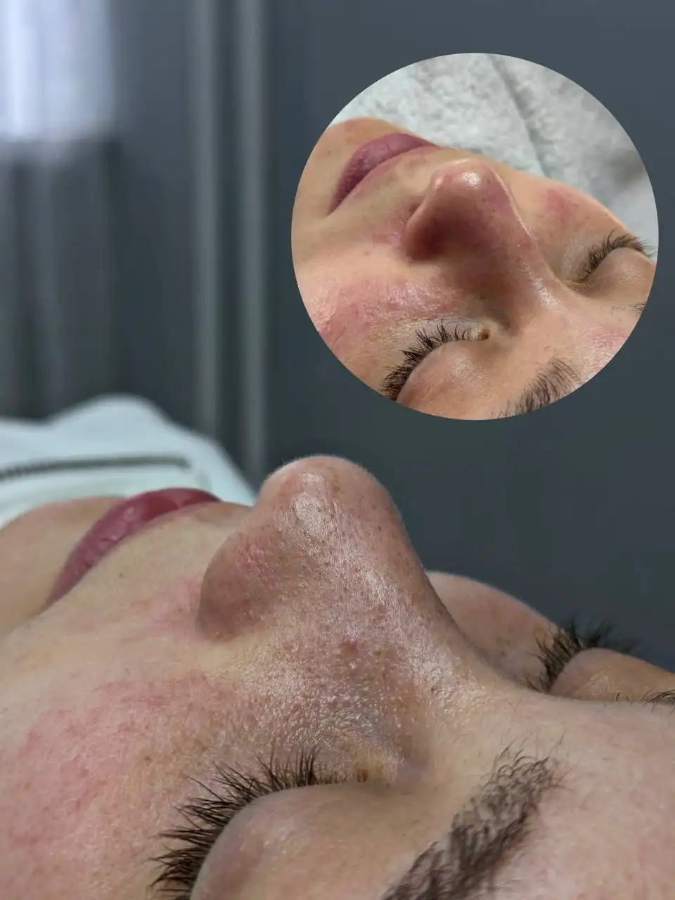 Услуги косметолога в Свердловском районе