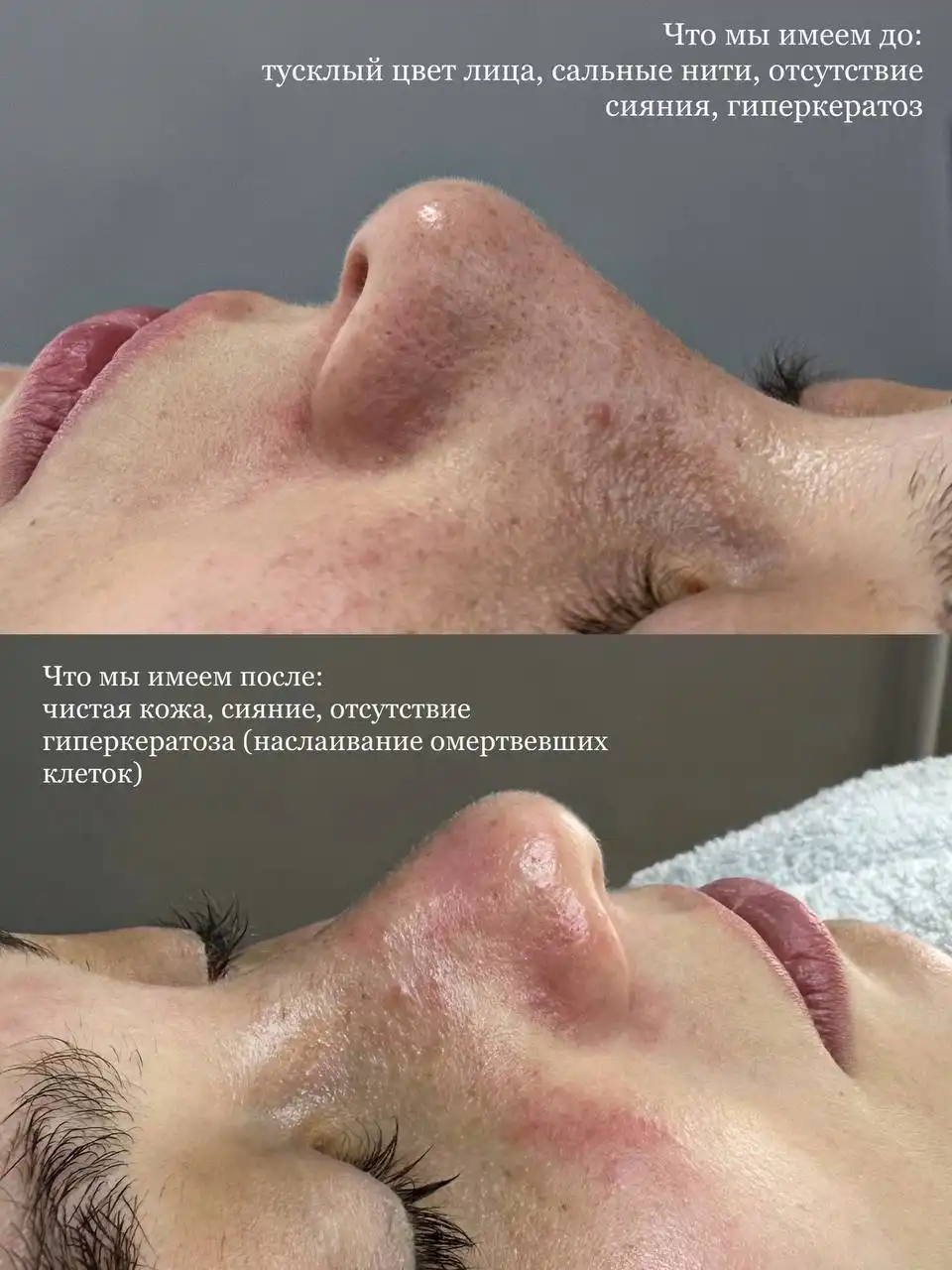 Новогодние косметологические процедуры для кожи