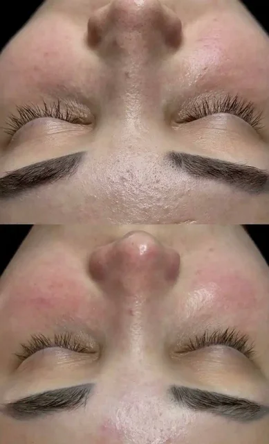 Комбинированная чистка лица со скидкой - частное объявление в Красноярск