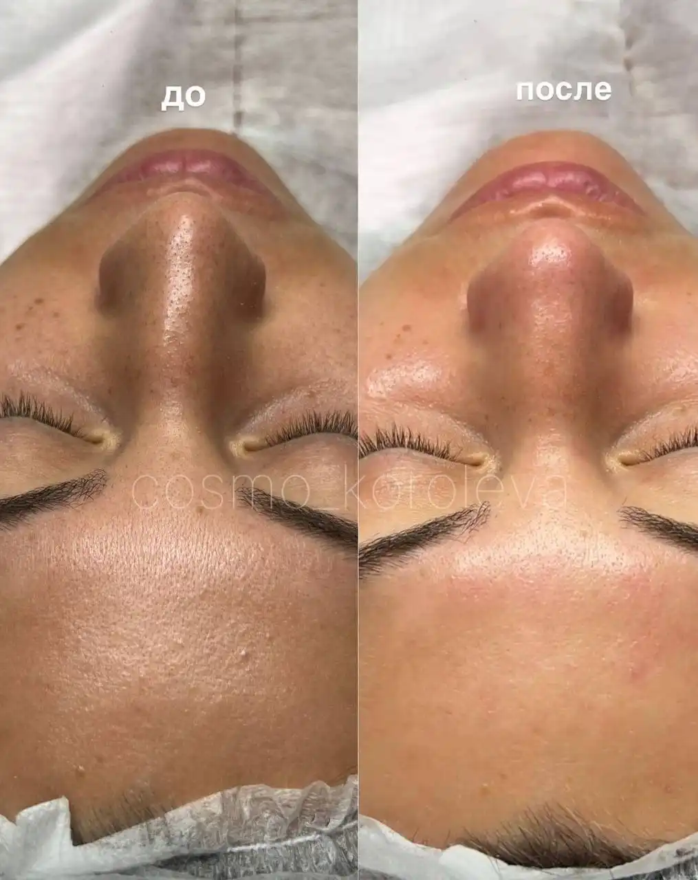 Акции февраля на косметологические процедуры - Косметология (Красота и здоровье) в Красноярск