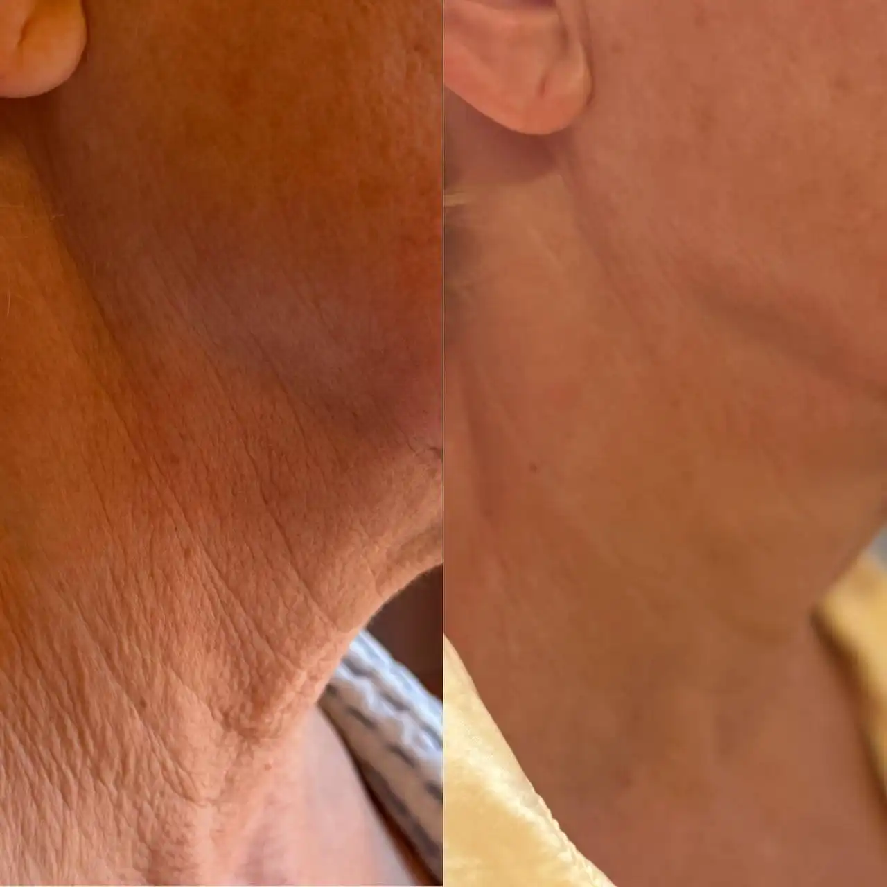 Акции февраля на косметологические процедуры - Косметология (Красота и здоровье) в Красноярск