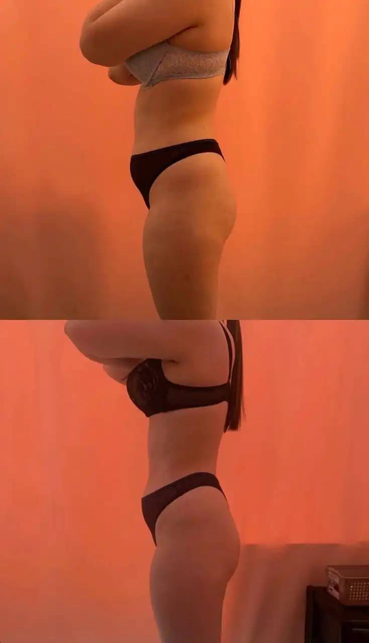 Аппаратный массаж миостимуляцией для подготовки к весне и лету - Массаж (Услуги) в Красноярск