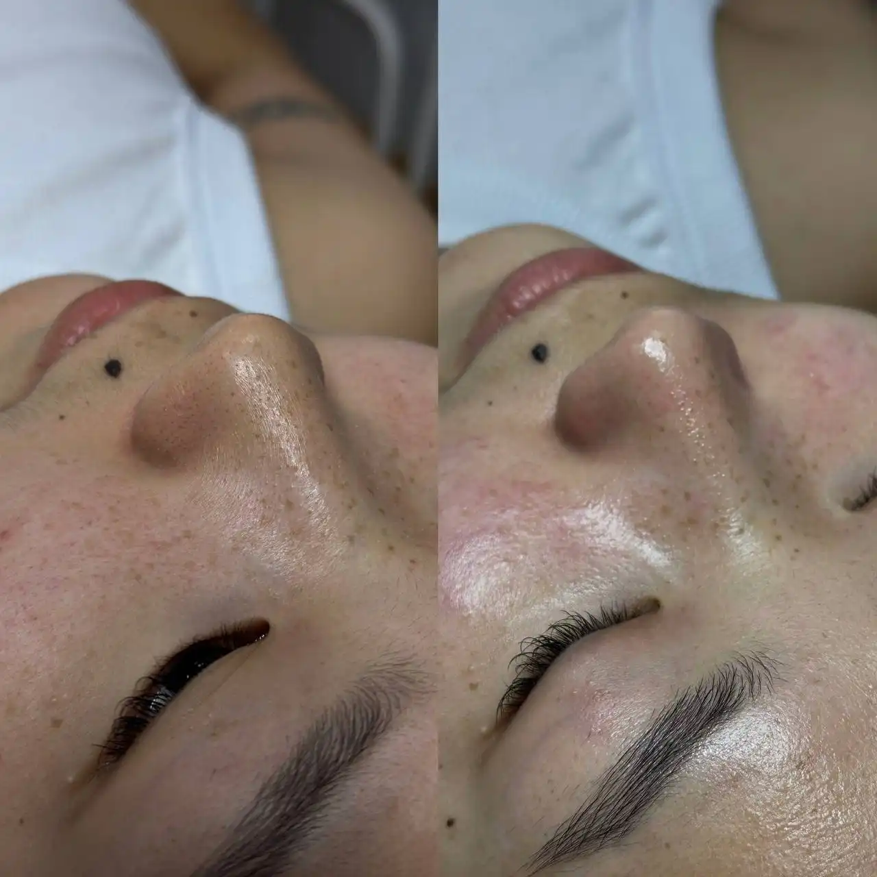 Чистка лица для моделей с проблемной кожей - Косметология (Услуги) в Красноярск