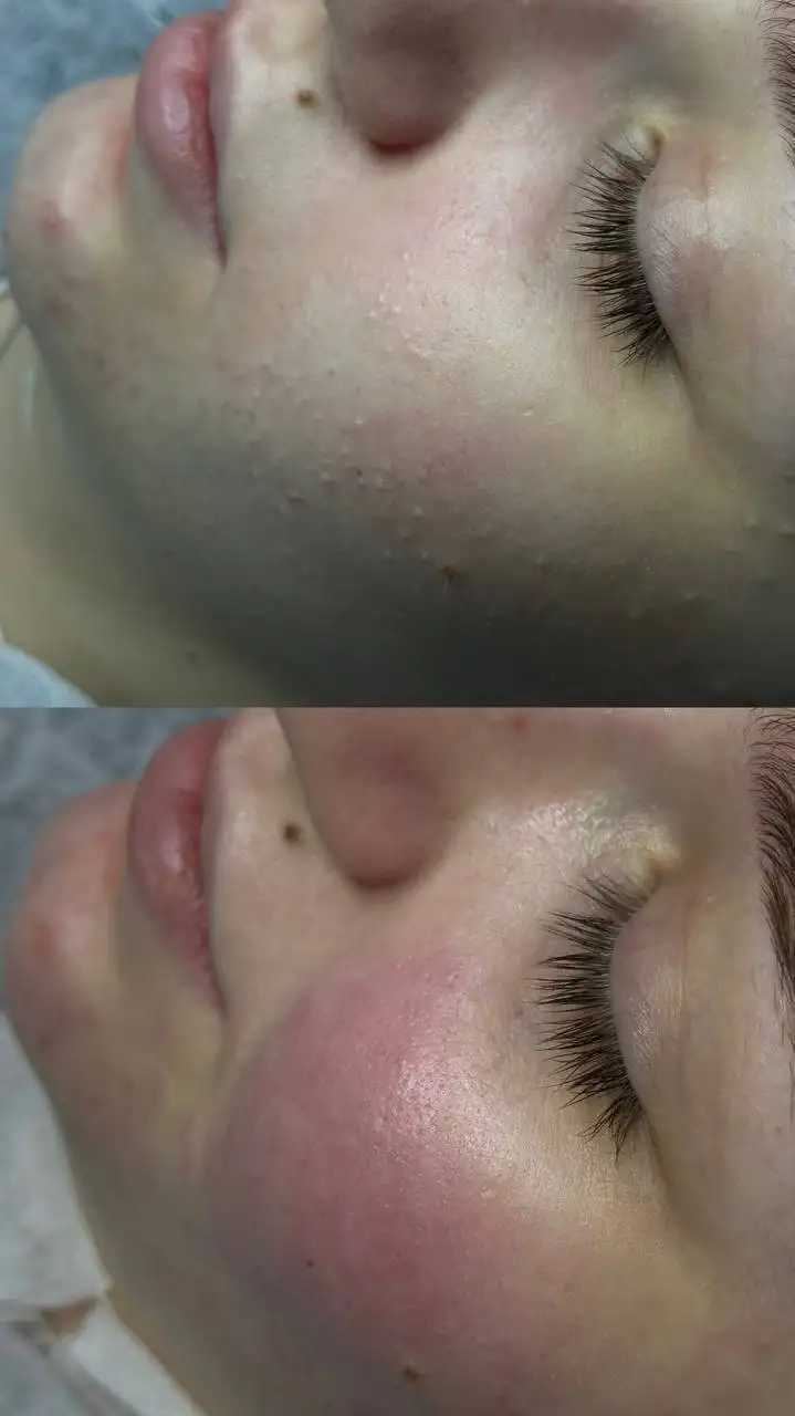 Услуги дипломированного косметолога в Красноярске - Косметология (Услуги) в Красноярск