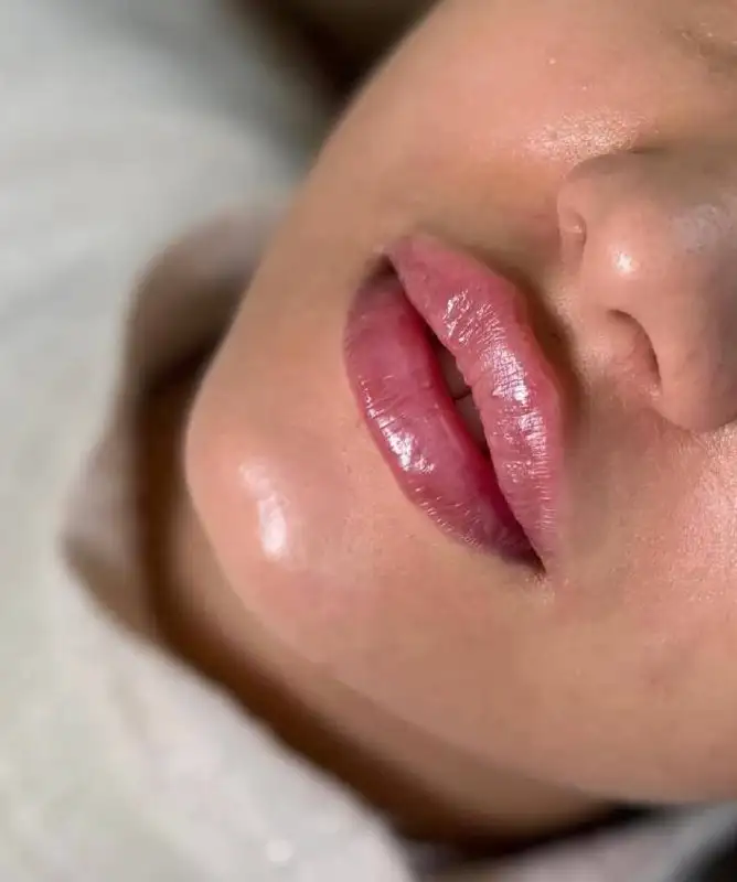 Услуги по омоложению и гармонизации лица - Красота и здоровье в Красноярск