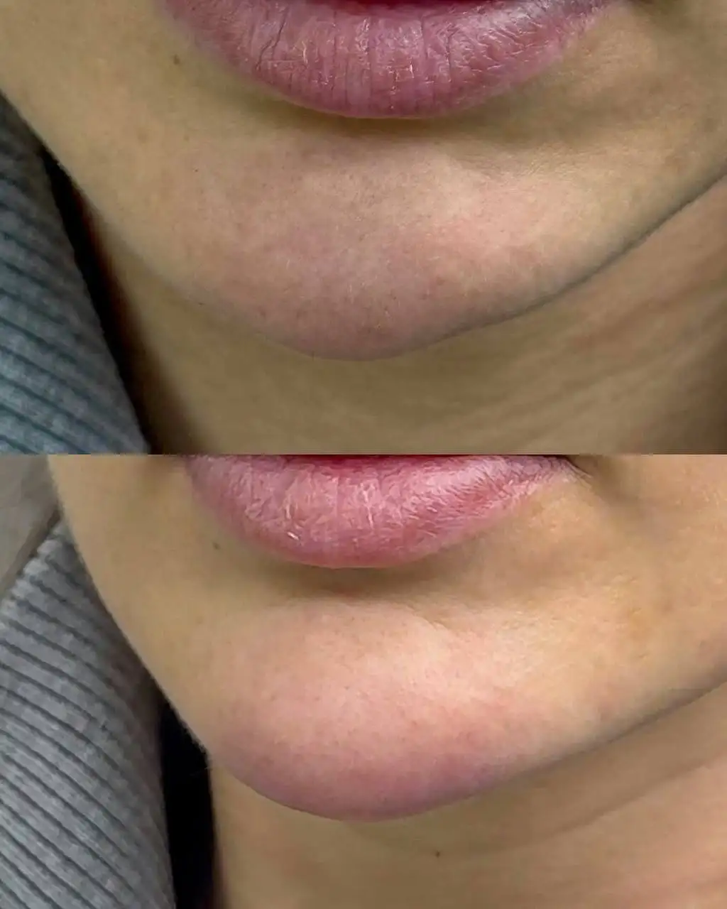 Услуги по омоложению и гармонизации лица - Красота и здоровье в Красноярск