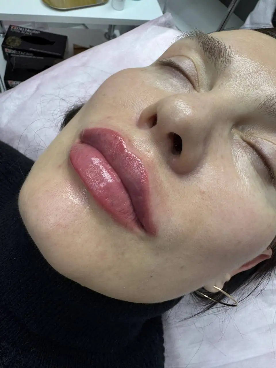 Контурная пластика губ к 8 Марта - Эстетическая косметология (Красота и здоровье) в Красноярск