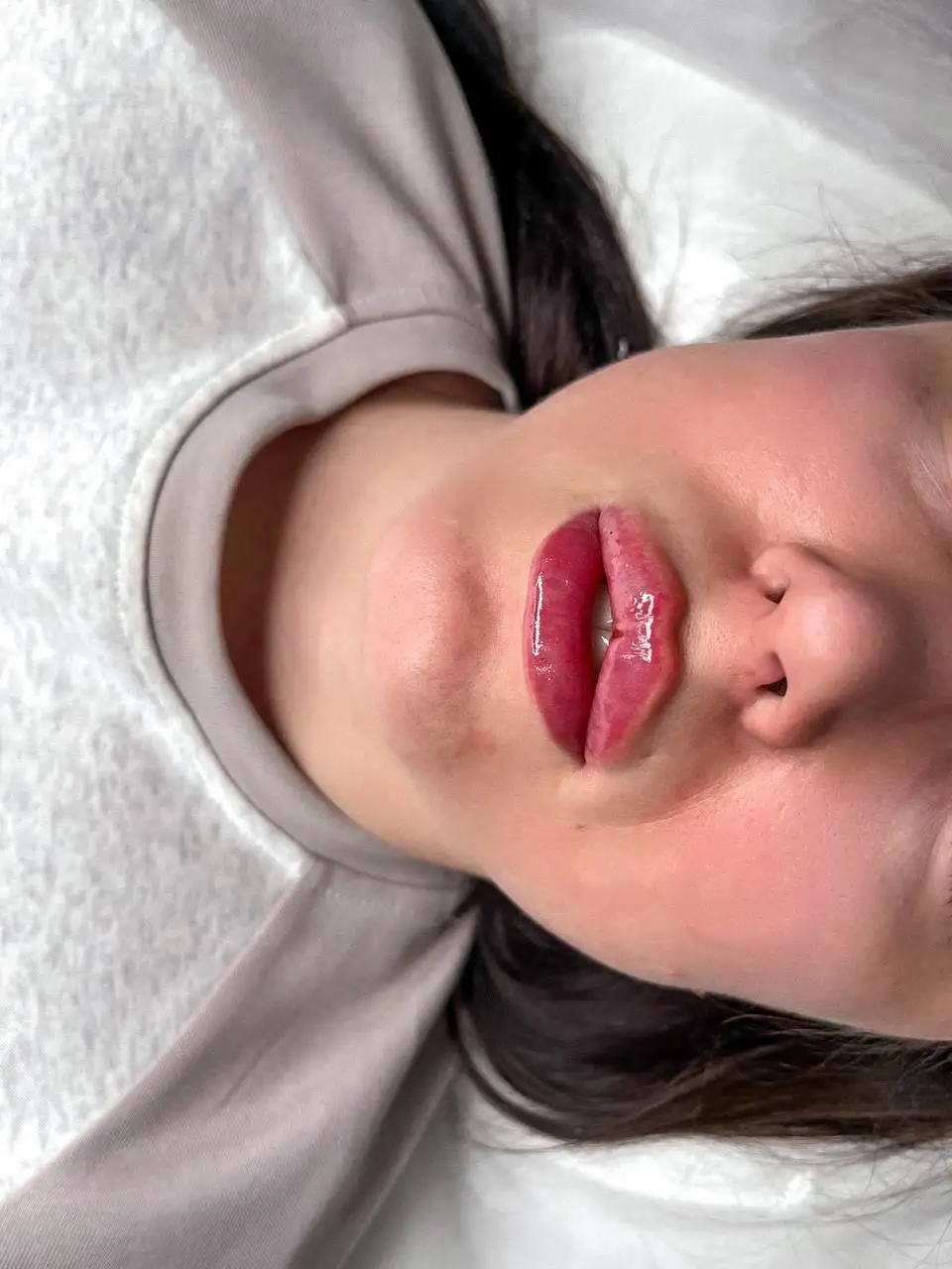 Контурная пластика губ - Косметология (Услуги) в Красноярск