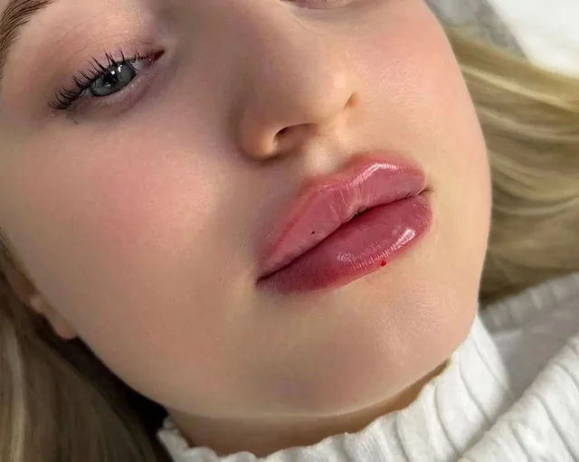 Услуги контурной пластики и ботулинотерапии в Красноярске - Уборка в Красноярск