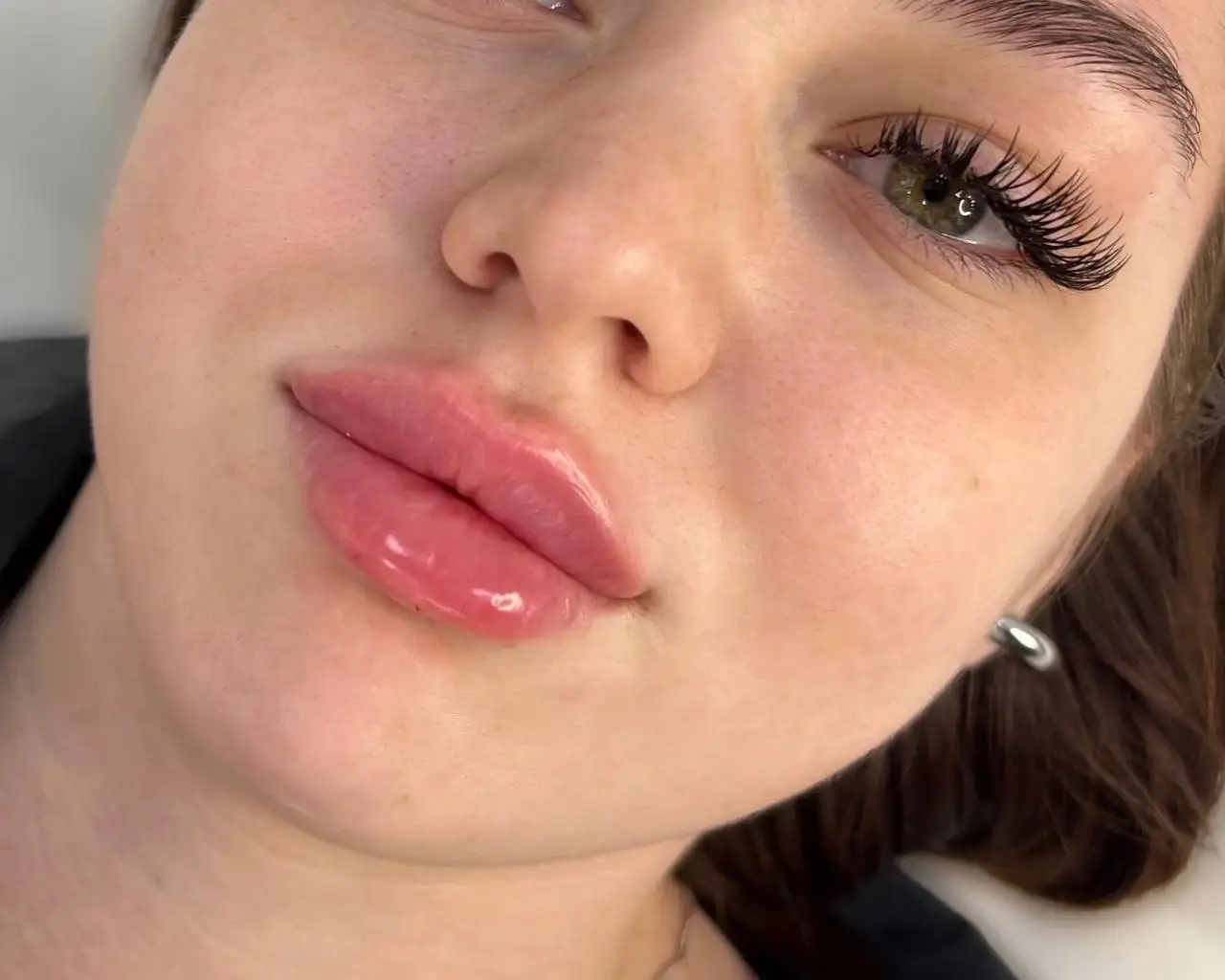 Услуги контурной пластики и ботулинотерапии в Красноярске - Красота и здоровье (Услуги) в Красноярск