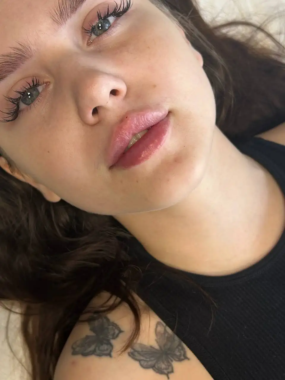 Услуги контурной пластики и ботулинотерапии в Красноярске - Красота и здоровье (Услуги) в Красноярск