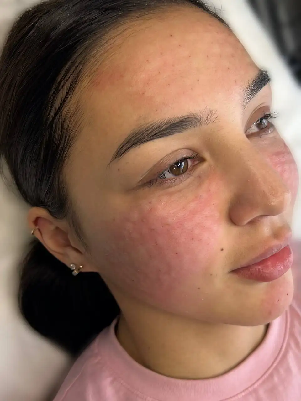 Услуги контурной пластики и ботулинотерапии в Красноярске - Красота и здоровье (Услуги) в Красноярск