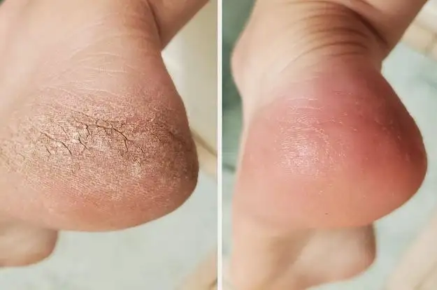 Набор моделей для педикюра в Покровке - Услуги в Красноярск