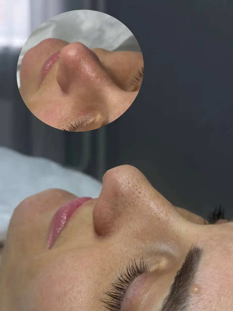 Услуги дипломированного косметолога в Красноярске - Красота и здоровье (Услуги) в Красноярск