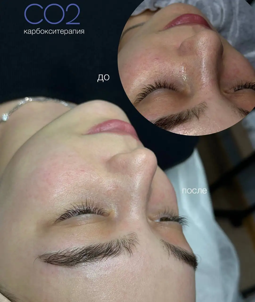 Услуги дипломированного косметолога в Красноярске - Красота и здоровье (Услуги) в Красноярск