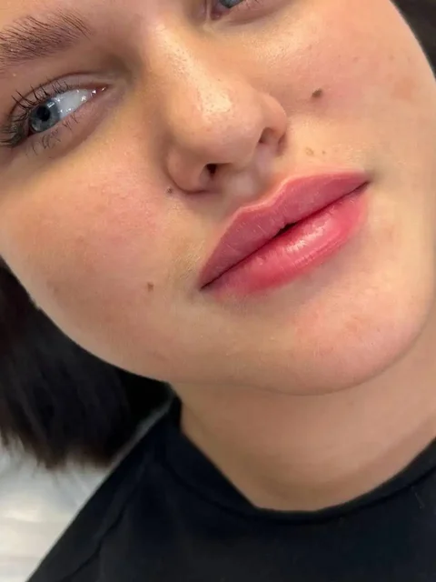 Услуги контурной пластики, ботулинотерапии и мезотерапии в Красноярске - VPN в Красноярск