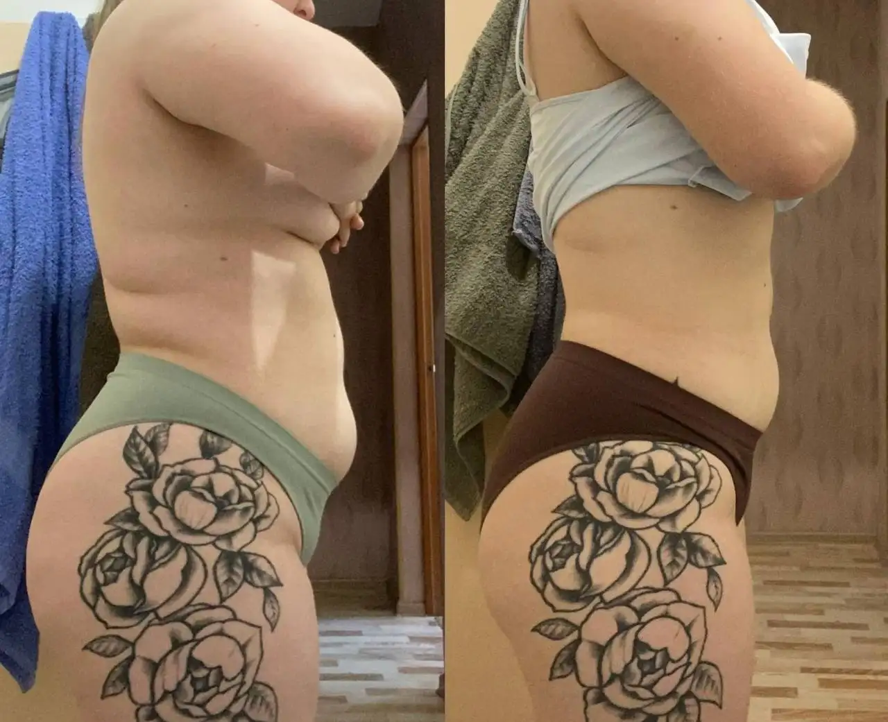 Услуги контурной пластики, ботулинотерапии и мезотерапии в Красноярске - Красота и здоровье (Услуги) в Красноярск