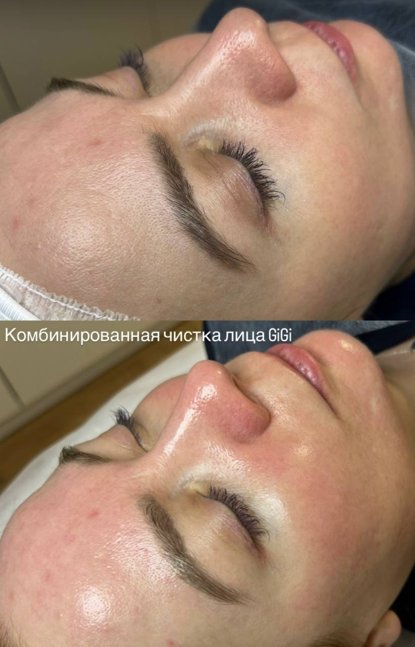 Косметологические процедуры - Красота и здоровье в Казань