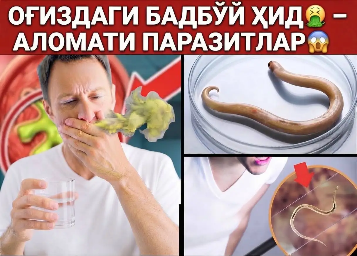 Табиий дамлама оғиз ҳидидан халос қилади - Красота и здоровье в Уфа