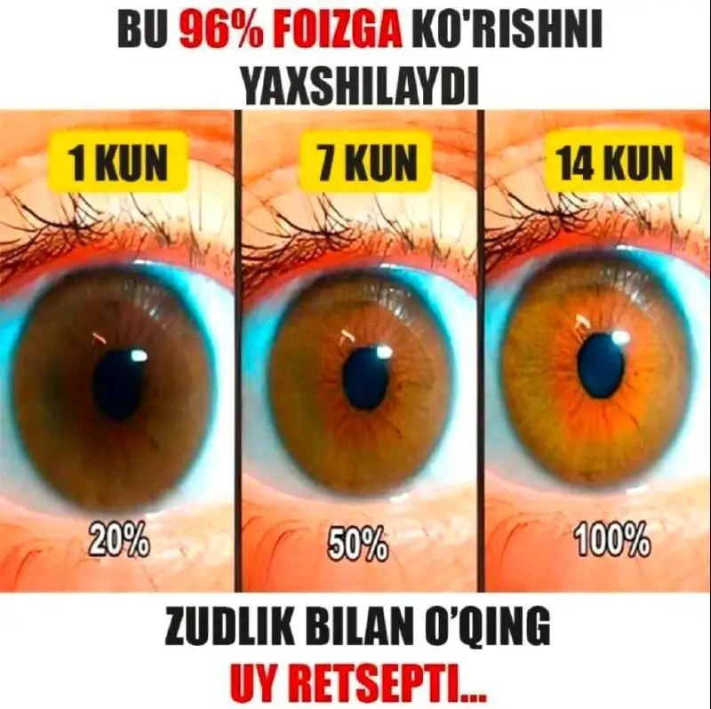 Куришни 7 кун ичида тикланг - Барахолка в Уфа
