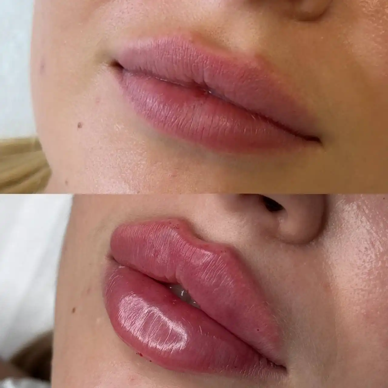 Перманентный макияж и косметология в Емельяново - Косметология (Красота и здоровье) в Емельяново