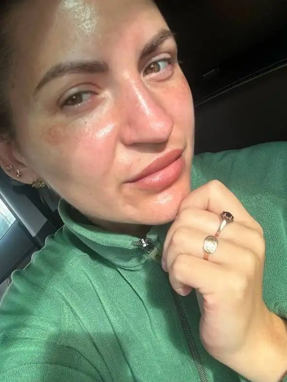 Холодная плазма: процедура для омоложения кожи - Косметология (Услуги) в Солонцы