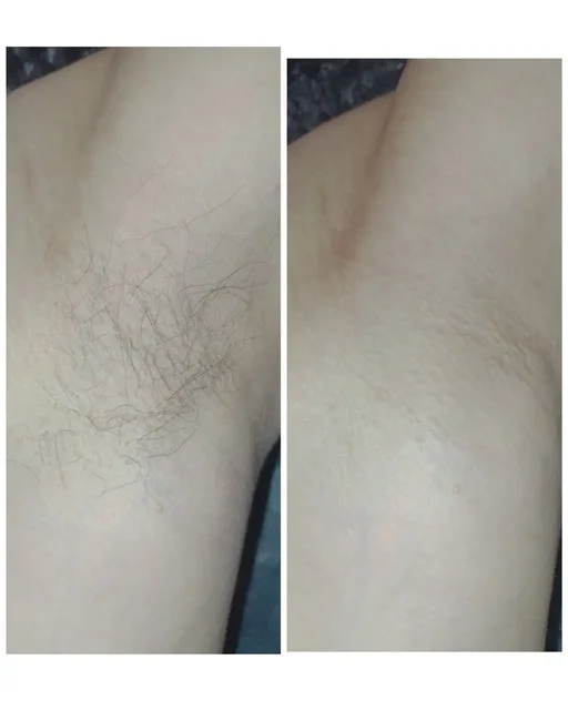 Услуги мастера по депиляции для отработки навыков - Строительство и ремонт в Иваново