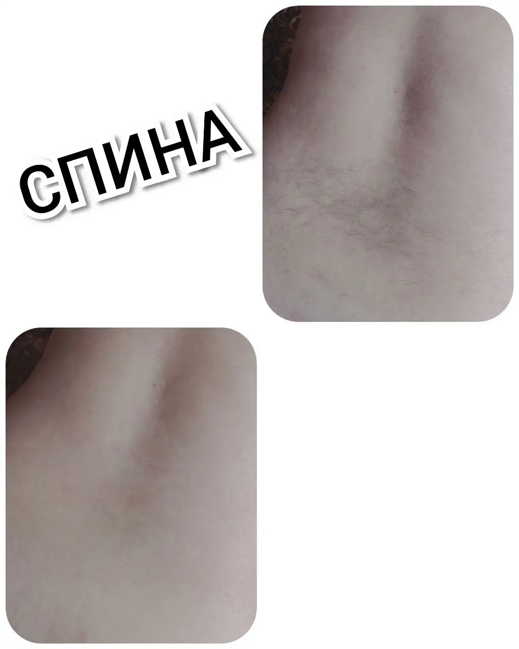 Услуги мастера по депиляции для отработки навыков - Красота (Услуги) в Иваново