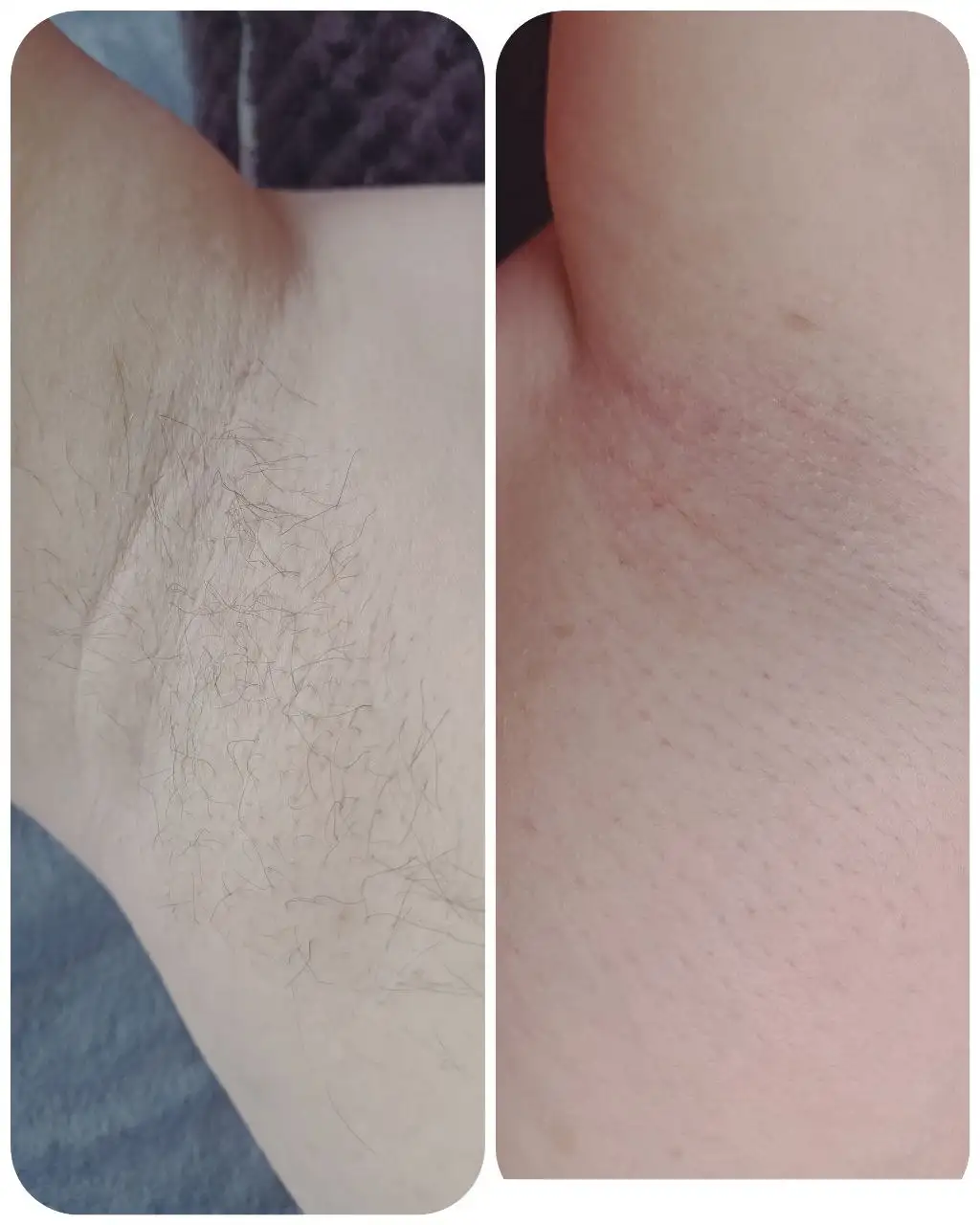 Услуги мастера по депиляции для отработки навыков - Красота (Услуги) в Иваново