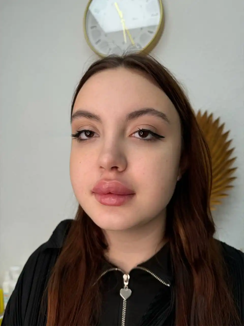 Увеличение губ в Москве - Услуги в Москва