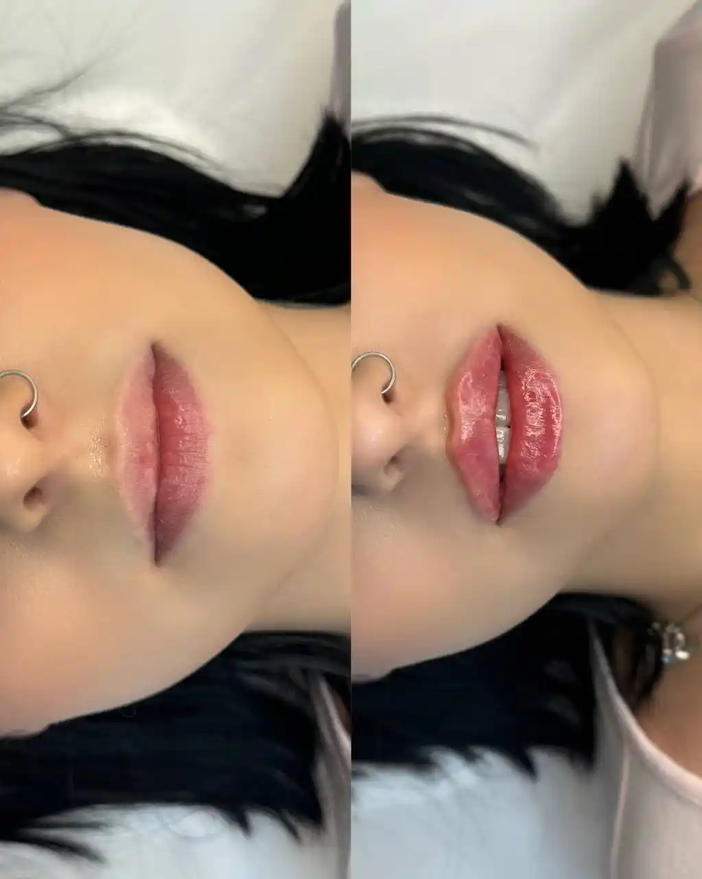 Нужны модели на контурную пластику - частное объявление в Ставрополь