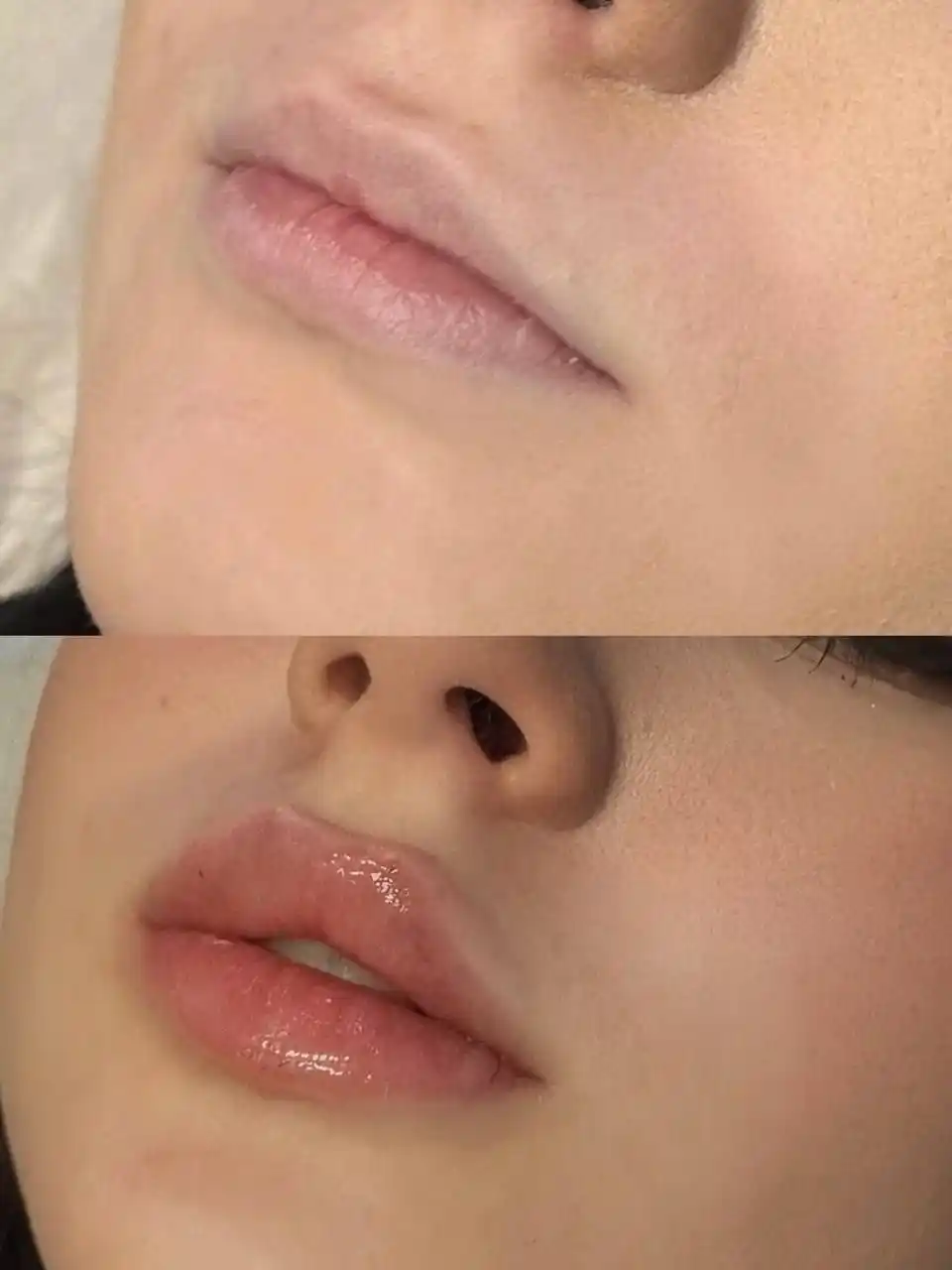 Нужны модели на контурную пластику