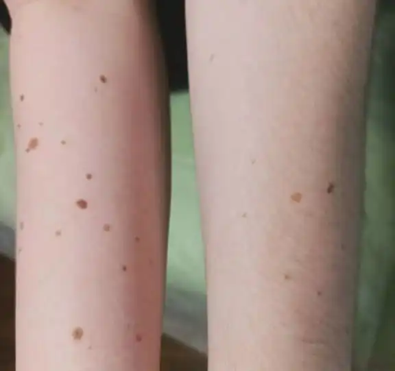 Услуги мастера депиляции на дому в Ставрополе