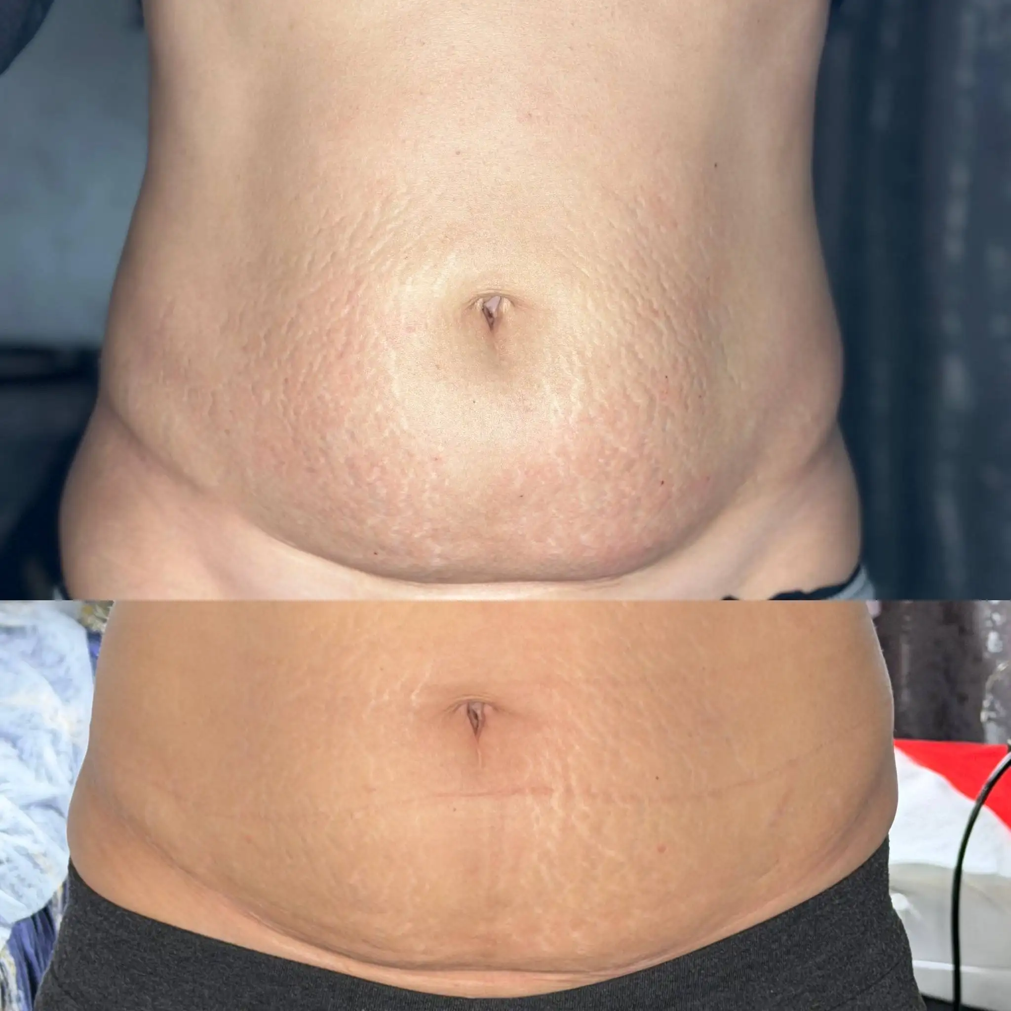 Услуги косметолога с медицинским образованием - Косметология (Услуги) в Ставрополь