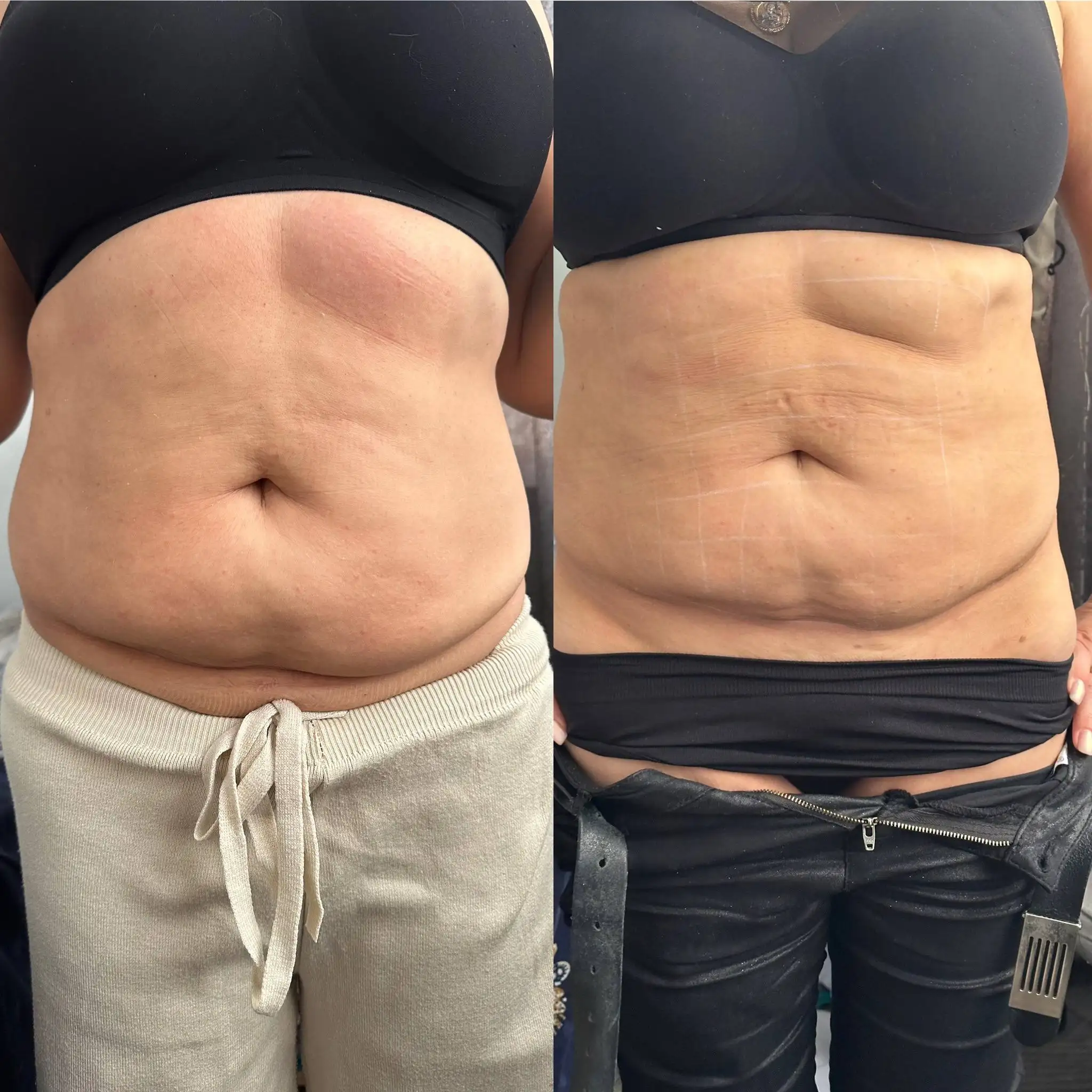 Услуги косметолога с медицинским образованием - Косметология (Услуги) в Ставрополь