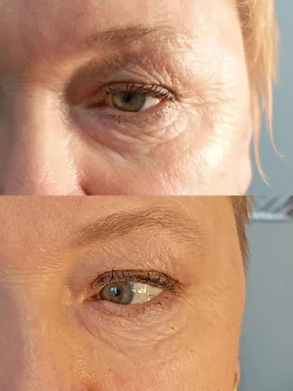 Услуги косметолога с медицинским образованием - Косметология (Услуги) в Ставрополь