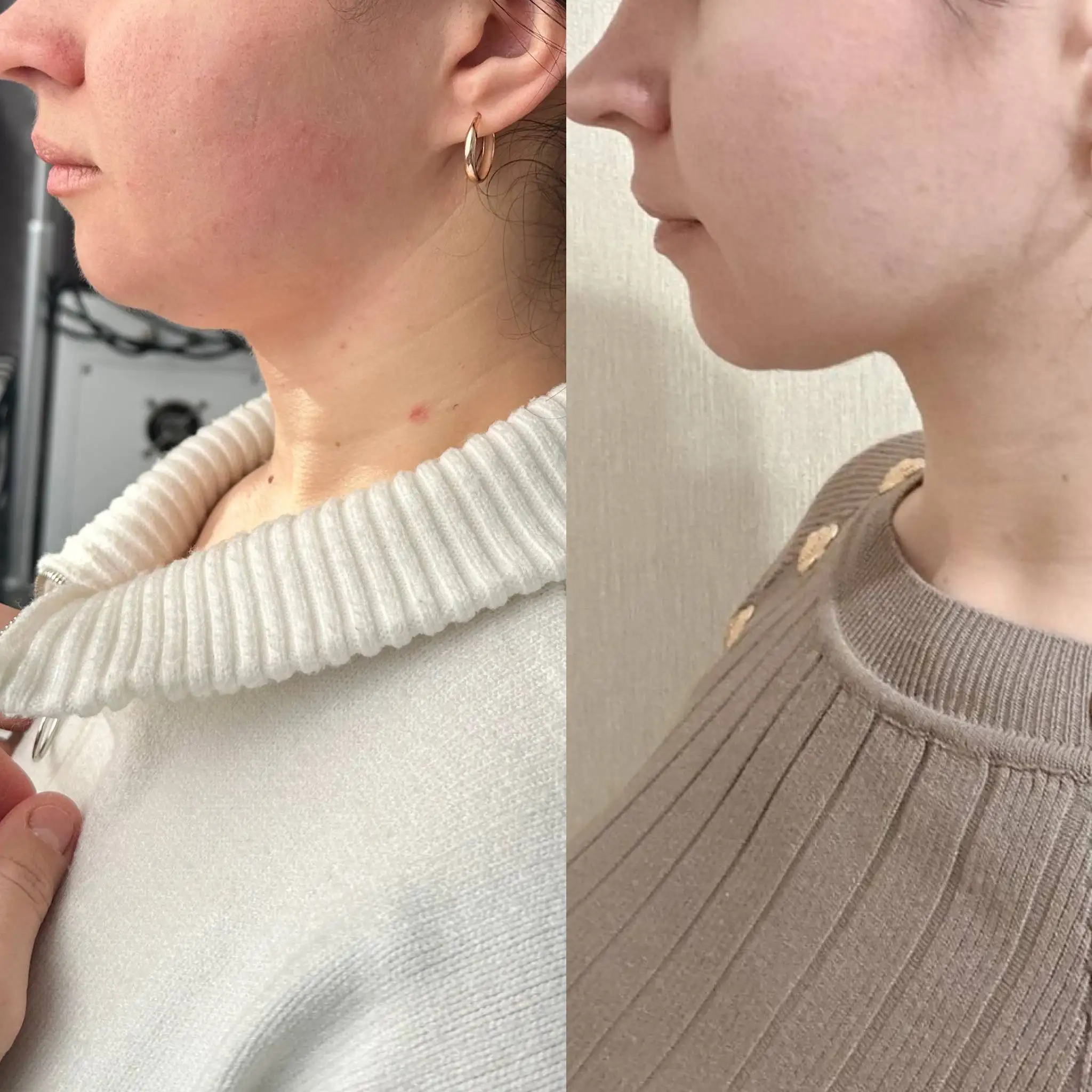 Услуги косметолога с медицинским образованием - Косметология (Услуги) в Ставрополь