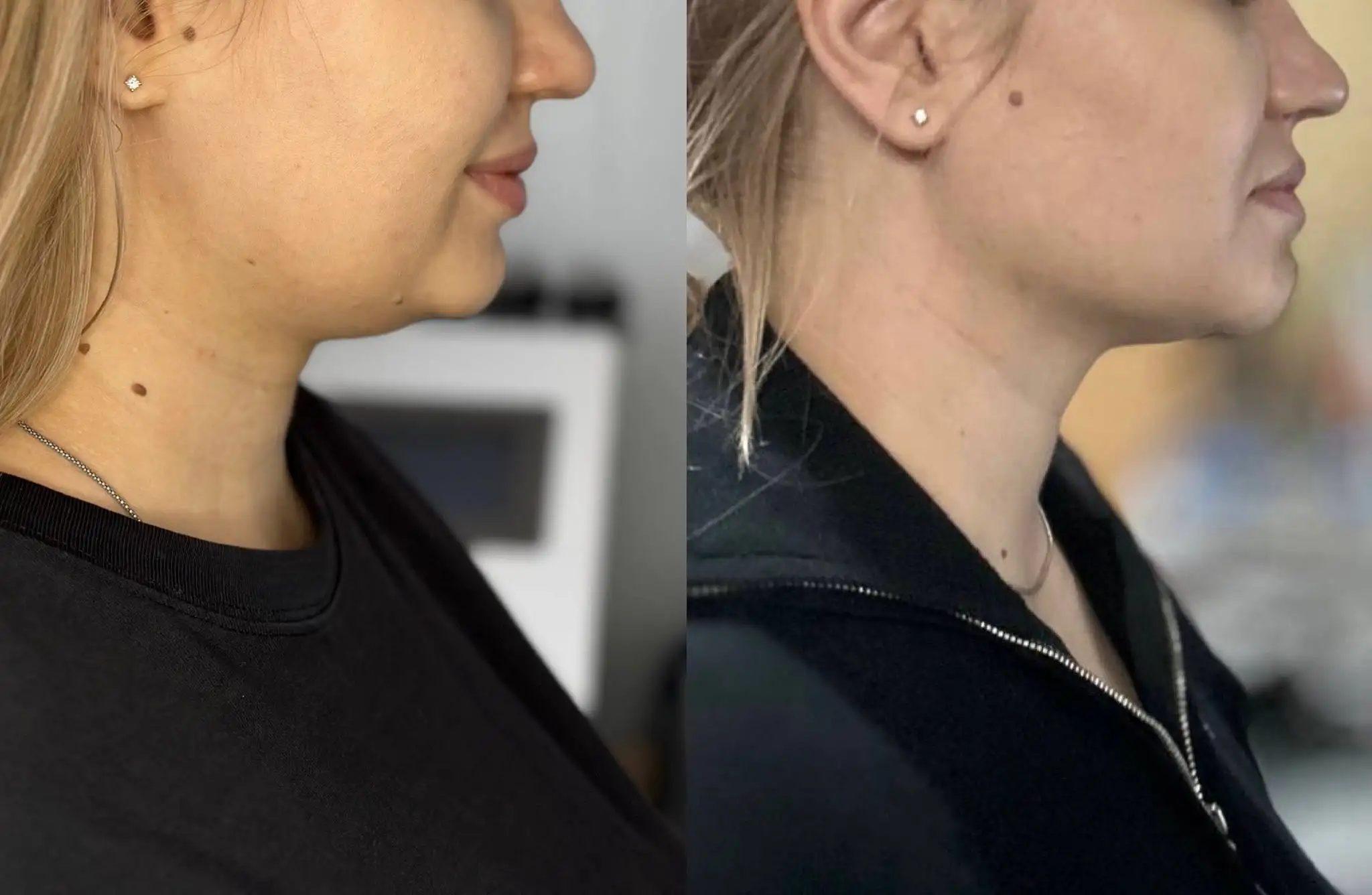 Услуги косметолога с медицинским образованием - Косметология (Услуги) в Ставрополь