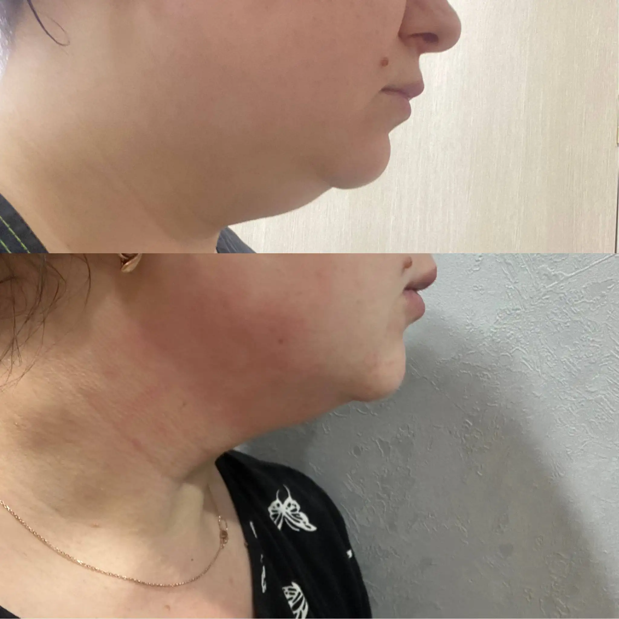 Услуги косметолога с медицинским образованием - Косметология (Услуги) в Ставрополь