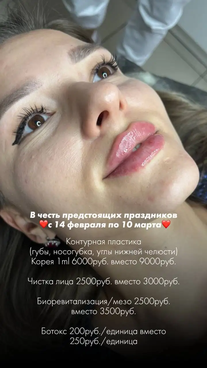 Услуги косметолога Тамары в Ставрополе - Косметология (Услуги) в Ставрополь