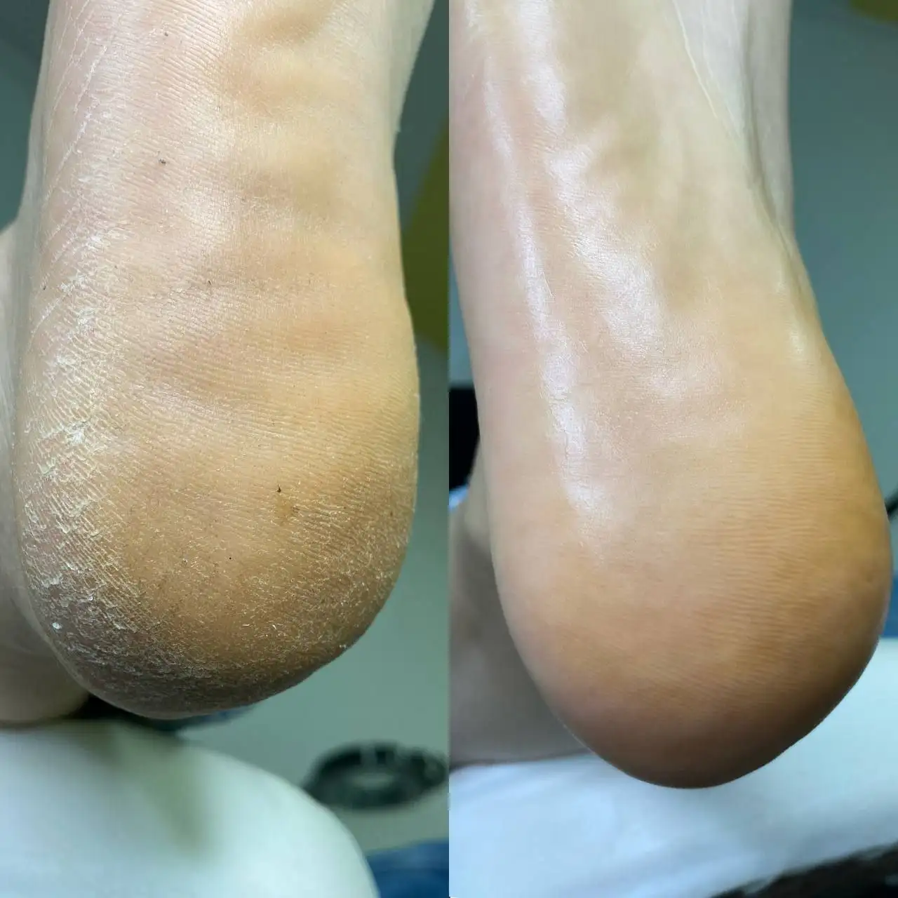 Маникюр и SMART педикюр от опытного мастера - Красота (Услуги) в Ставрополь