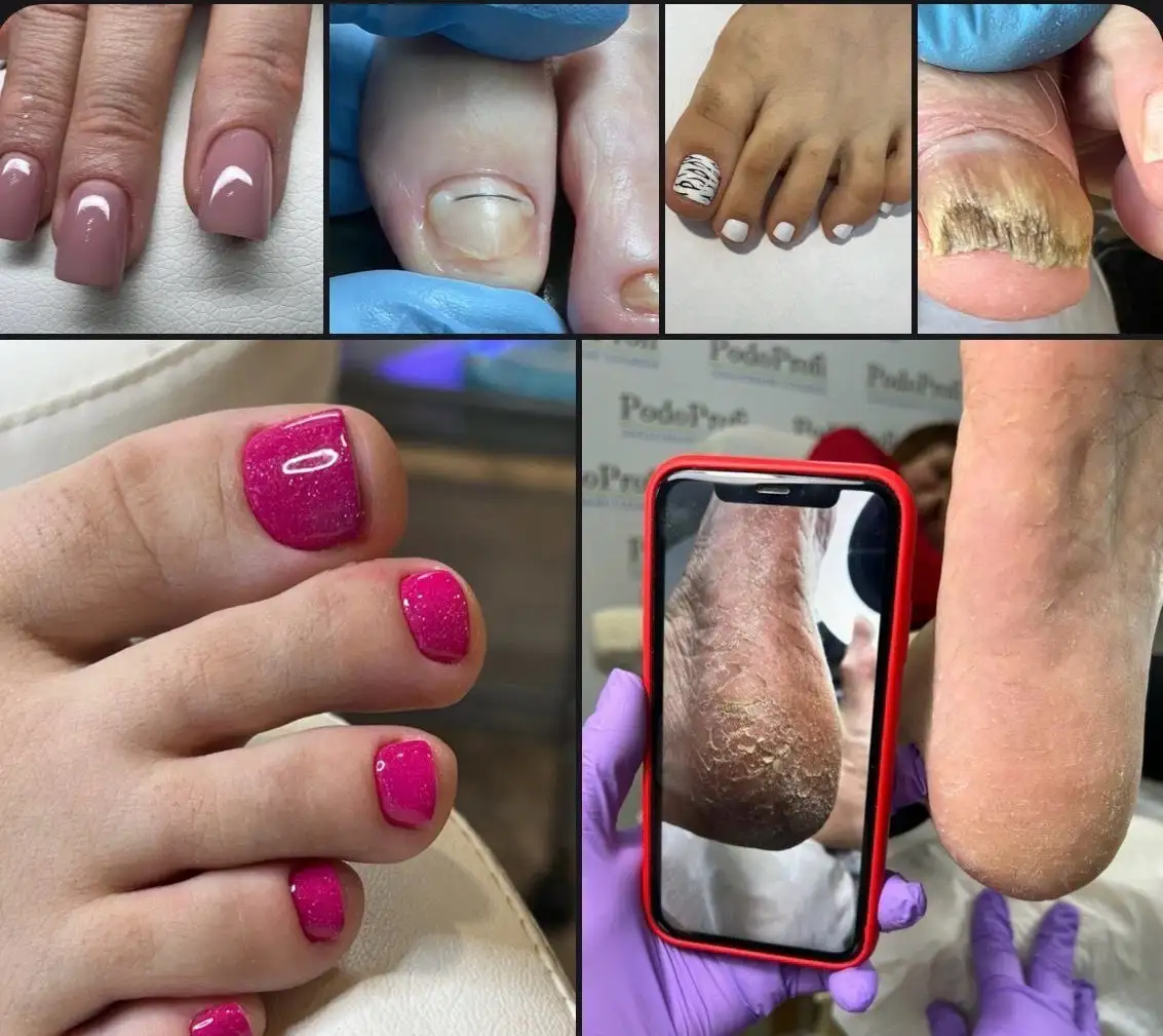 Профессиональные услуги маникюра и педикюра с медицинским подходом - Красота и здоровье (Услуги) в Ставрополь