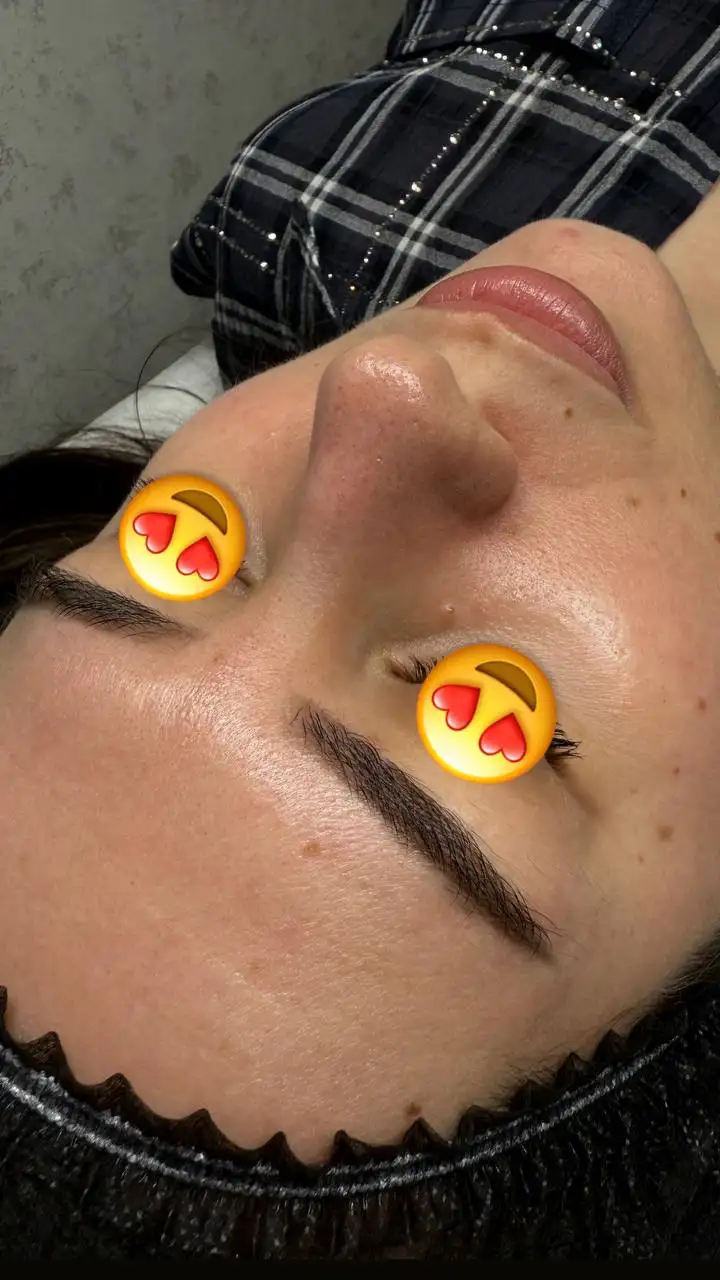 Комбинированная чистка лица с пилингом BioRePeel - Косметология (Услуги) в Ставрополь