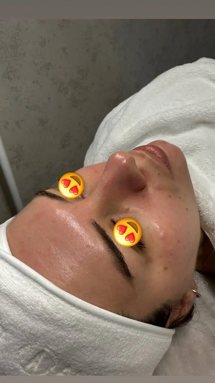 Комбинированная чистка лица с пилингом BioRePeel - Косметология (Услуги) в Ставрополь