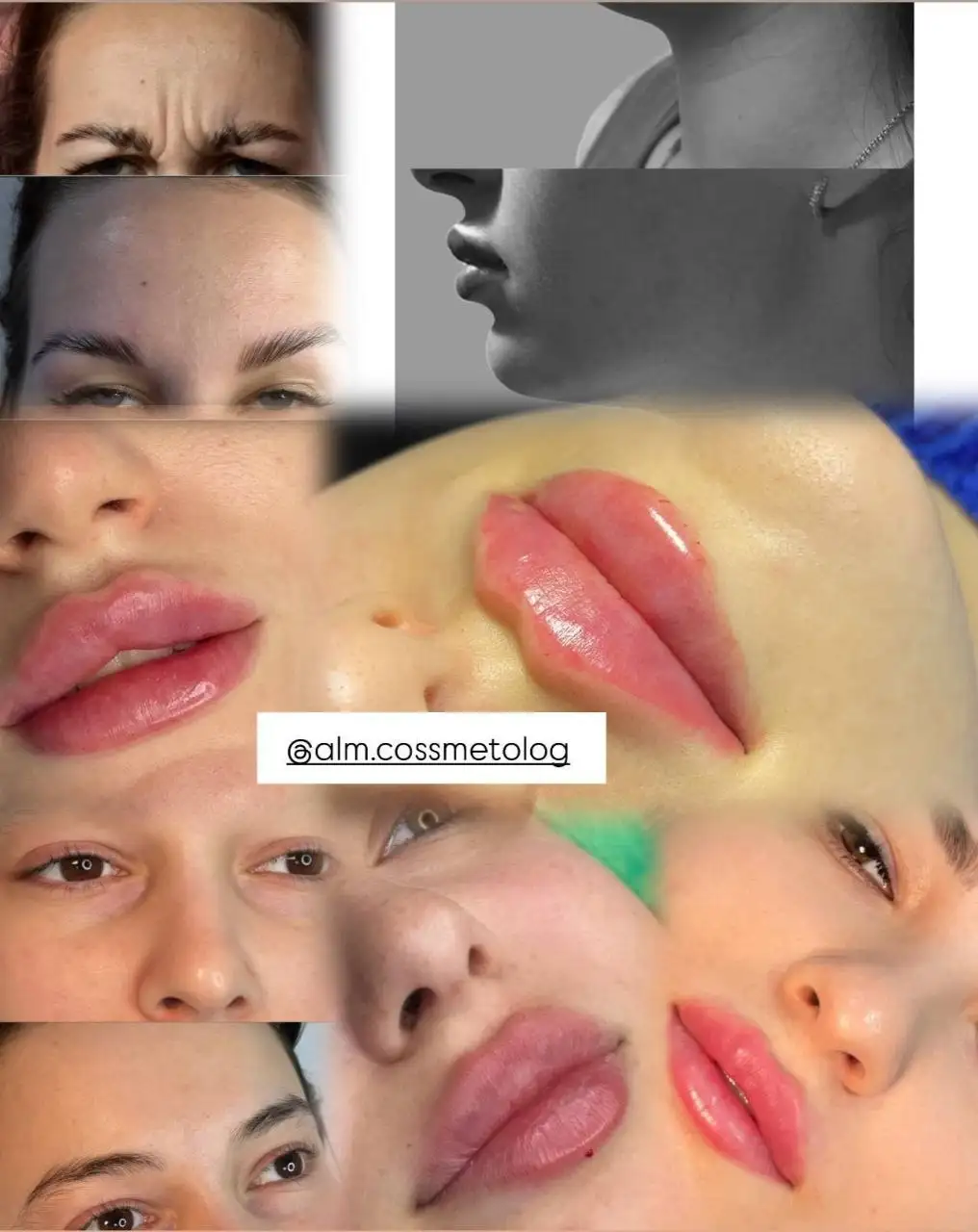 Услуги косметолога для пополнения портфолио - Косметология (Услуги) в Ставрополь