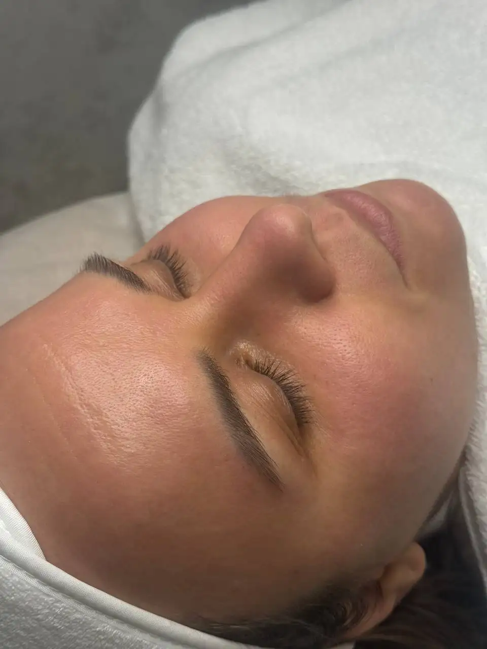 Чистка и пилинг кожи - Красота и здоровье в Ставрополь