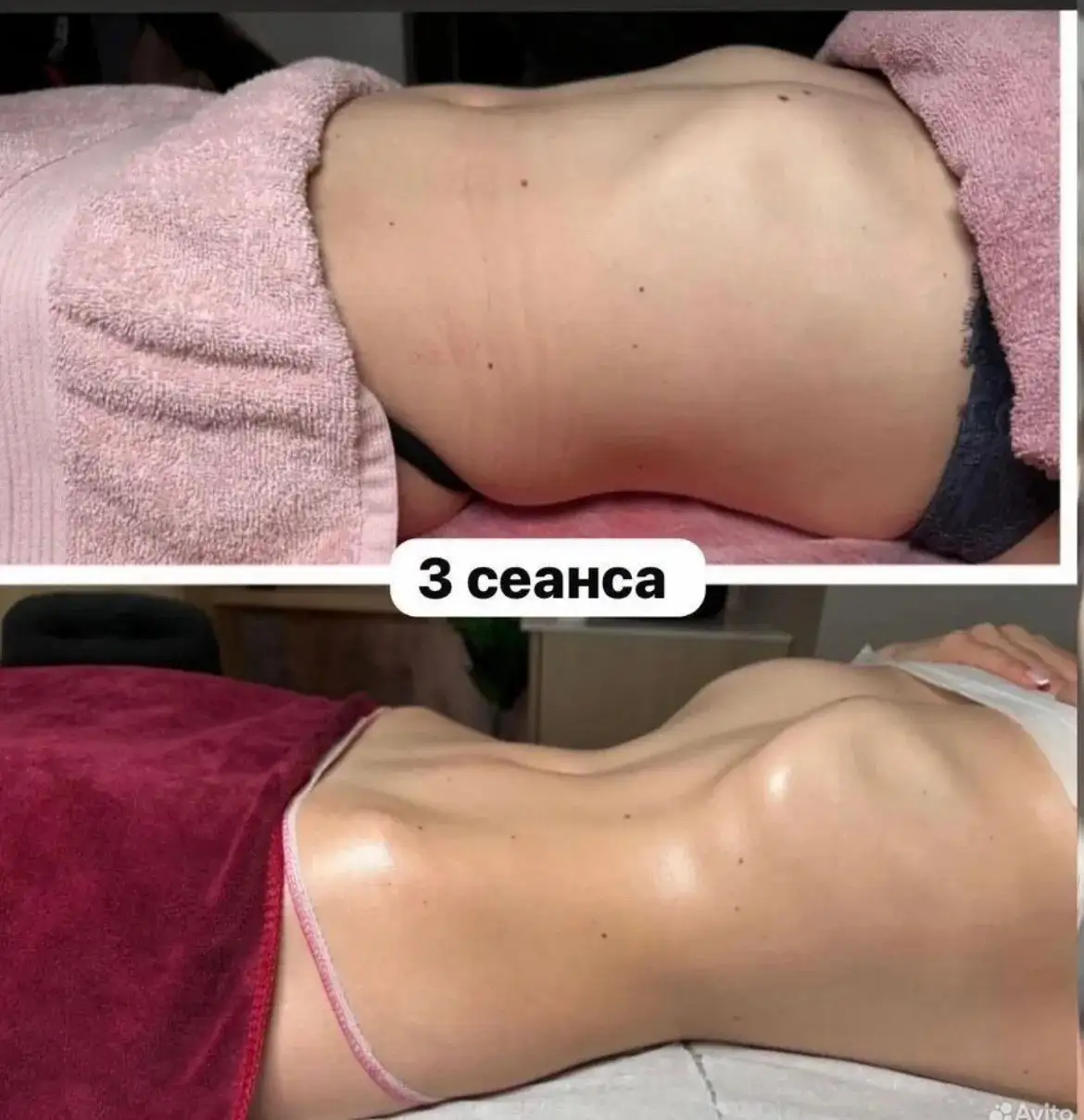 Массажист ищет модели на курс - Массаж (Услуги) в Ставрополь