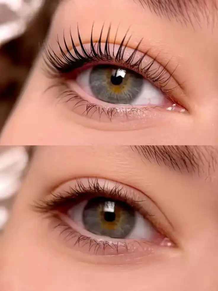 Косметологические процедуры в Яблоновском - Косметология (Красота и здоровье) в Яблоновский