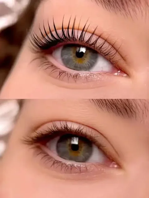 Косметологические процедуры в Яблоновском - Красота и здоровье в Яблоновский