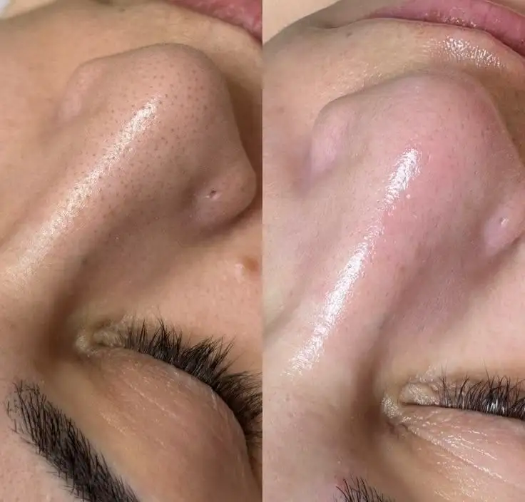 Студия красоты с инновационными процедурами - Красота и здоровье (Услуги) в Яблоновский